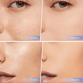 Pó Facial Anti-Rugas e Anti-Oleosidade - SACE LADY [Compre 1 & Leve 2] + Brindes Position 2