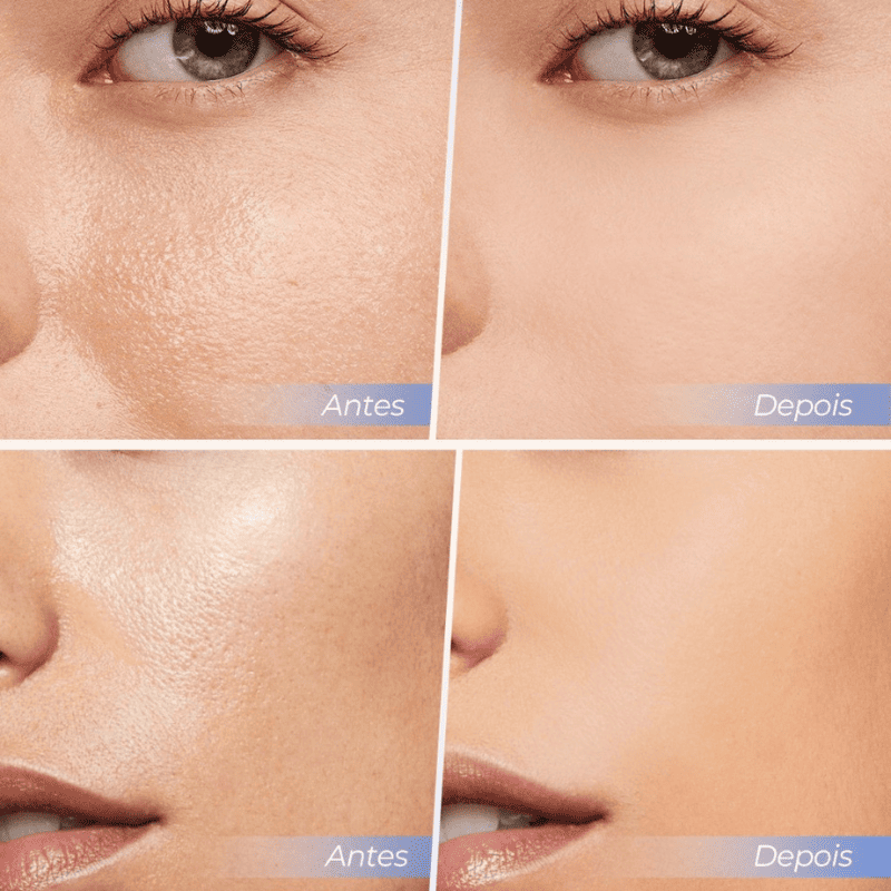 Pó Facial Anti-Rugas e Anti-Oleosidade - SACE LADY [Compre 1 & Leve 2] + Brindes Position 2
