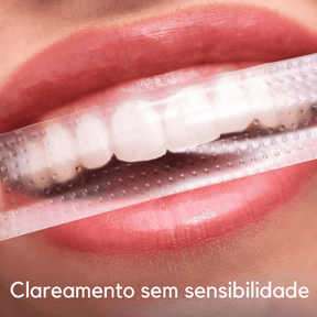 SmileKit – Clareamento total em 30 minutos Position 3