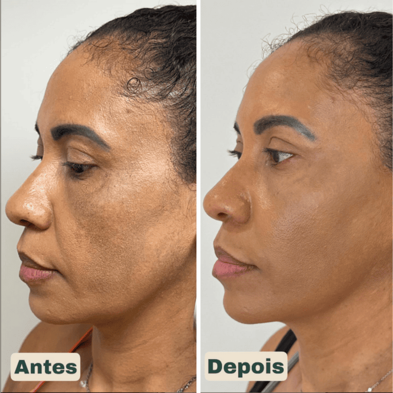 CollageSkin – Máscara Anti-idade com Efeito Lifting Position 5