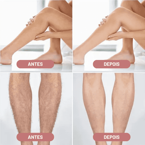 Depilador Elétrico 4 em 1 - DermaBelle® + Brindes Position 3
