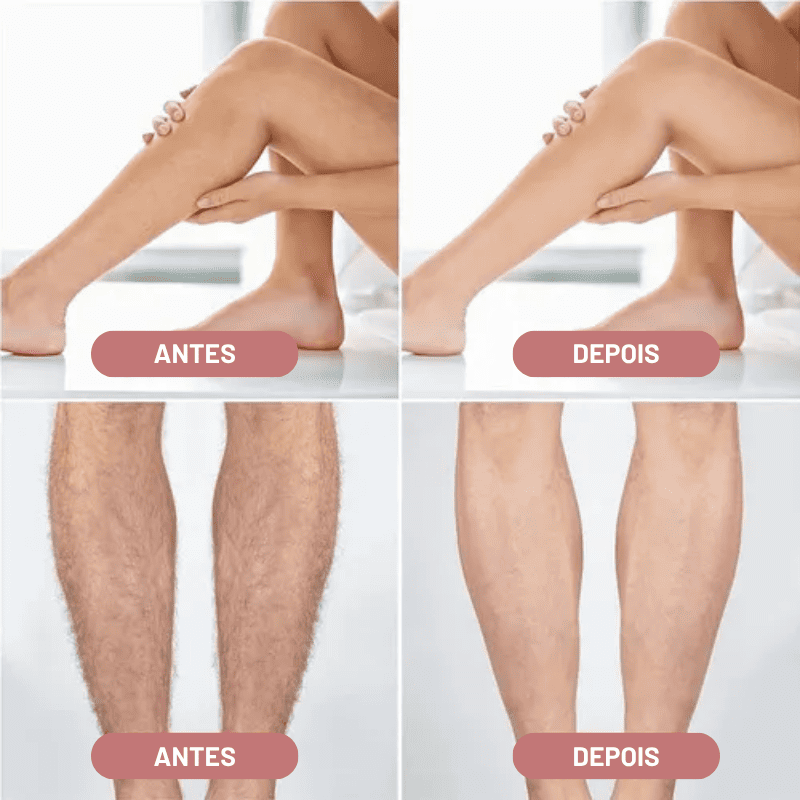 Depilador Elétrico 4 em 1 - DermaBelle® + Brindes Position 3