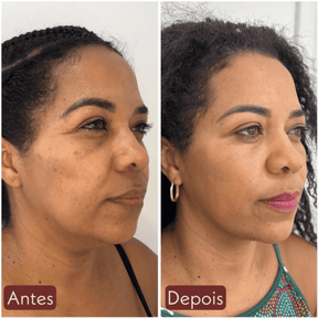 CollageSkin – Máscara Anti-idade com Efeito Lifting Position 8