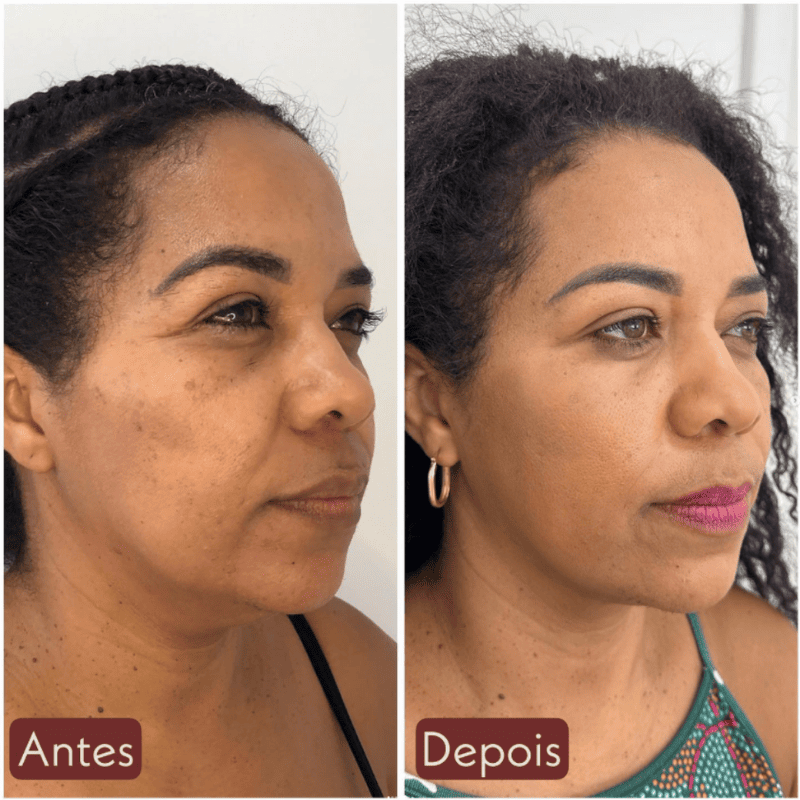 CollageSkin – Máscara Anti-idade com Efeito Lifting Position 8