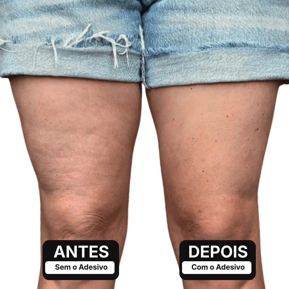Adesivo Lifting para Pernas – ClearLift™ [COMPRE 1 LEVE 2]