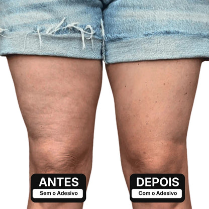 Adesivo Lifting para Pernas – ClearLift™ [COMPRE 1 LEVE 2]