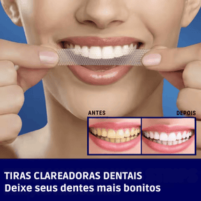 SmileKit – Clareamento total em 30 minutos Position 2