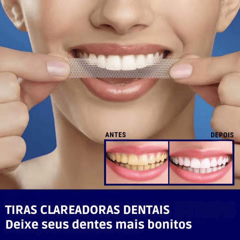SmileKit – Clareamento total em 30 minutos Position 2