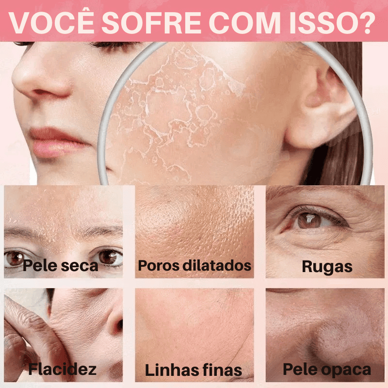 CollageSkin – Máscara Anti-idade com Efeito Lifting Position 3