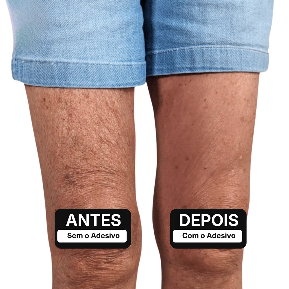 Adesivo Lifting para Pernas – ClearLift™ [COMPRE 1 LEVE 2]