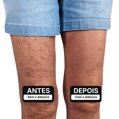 Adesivo Lifting para Pernas – ClearLift™ [COMPRE 1 LEVE 2]